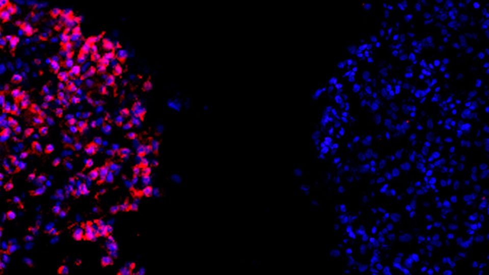 Researchers develop ground-breaking immunotherapy for aggressive brain cancer